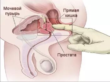 як робити масаж простати