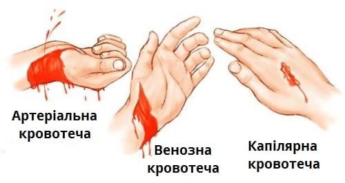 як зупинити кров із пальця