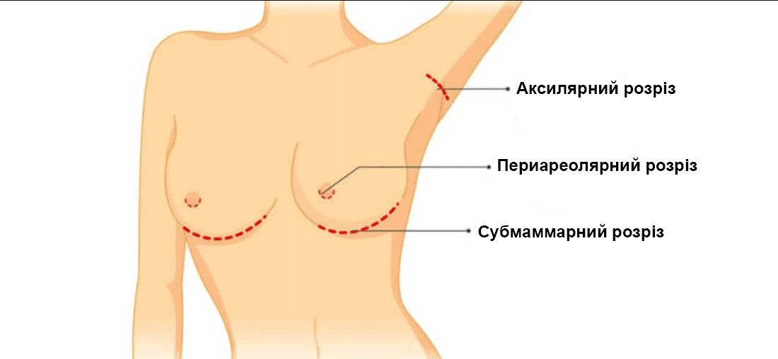 Як збільшити груди в домашніх умовах: ефективні методи та поради
